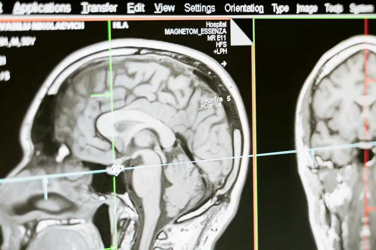 Les clés pour préserver la vitalité de votre cerveau au fil des années
