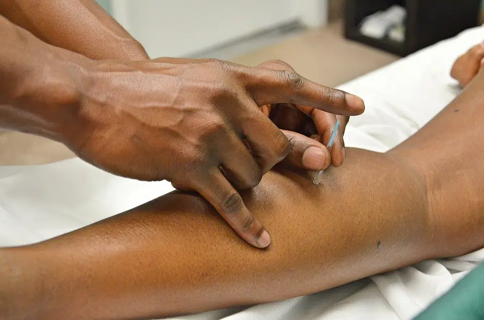 Découvrez les bienfaits de l’acupuncture sur l’organisme