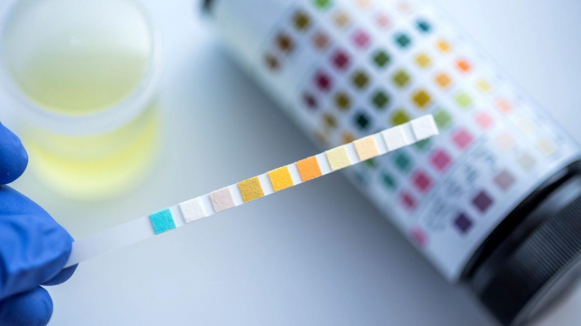 Bandelette urinaire : comment interpréter les résultats ?
