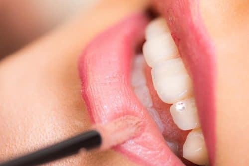 Cabinet dentaire : quels sont les domaines d’intervention ?