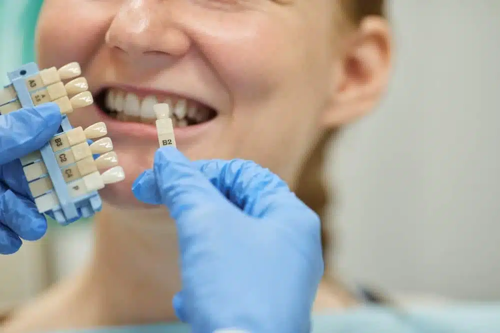 Comment trouver un implant dentaire pas cher et de qualité ?